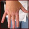 Leucoderma